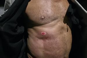 Ennesima aggressione per strappare una catenina d'oro a Viareggio da parte dei soliti maranza
